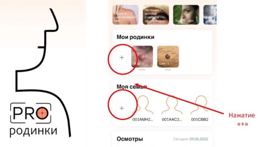 Нейросеть против меланомы: как разработка нижегородских ученых помогает бороться с опасным заболеванием